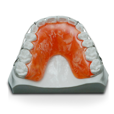 Orthodontics Lab - Wraparound Retainer